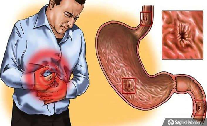 Gastrit veya reflünüz varsa bu 5 gıdayı asla tüketmeyin!