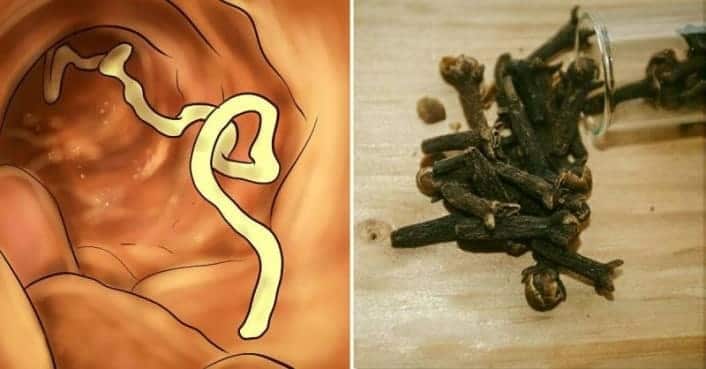 Vücudunuzda parazit olduğunu gösteren 10 belirti ve onları yok edecek 7 gıda