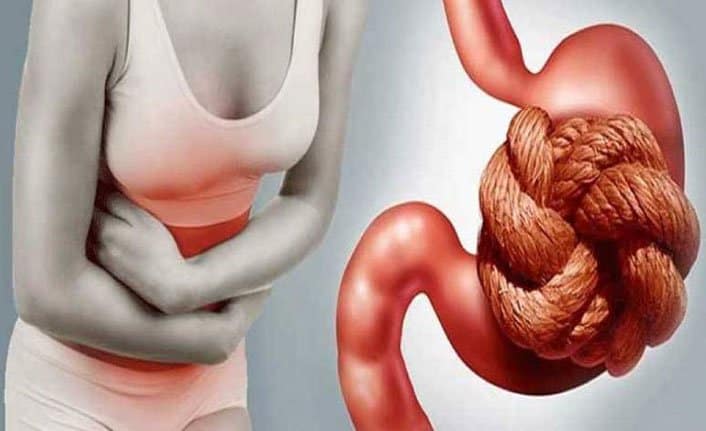 Kabızlık Belirtileri Neler Kabızlık Nasıl Geçer Evde Bitkisel Çözüm