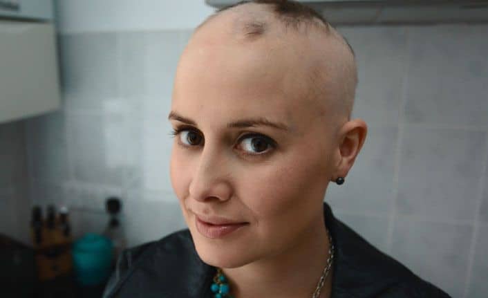 Alopesi Saç Dökülmesi Nedir Belirtileri, Nedenleri ve Tedavisi
